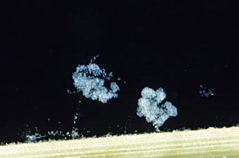 Glockentierchen, Vorticellidae in einer blumenförmigen  Kolonie zusammengezogen